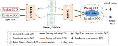 Pacing Electrocardiogram Detection With Memory-Based Autoencoder and Metric Learning